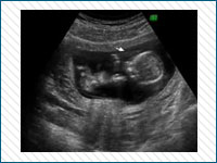 Pregnancy Stages
